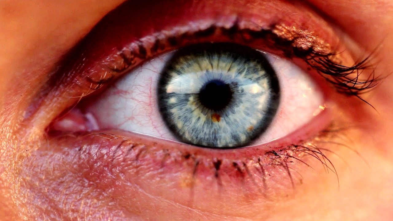 A solar eclipse can cook your eyes: How to watch safely