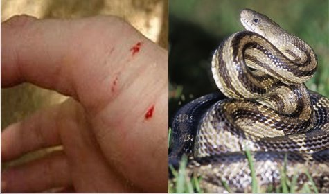 Liability for Snakes on My Land