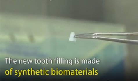 New Dental Fillings Could Allow Your Teeth To Heal Themselves [VIDEO]